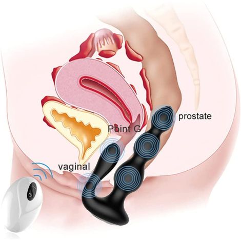 RemoteSilicone AnalBeads - 6